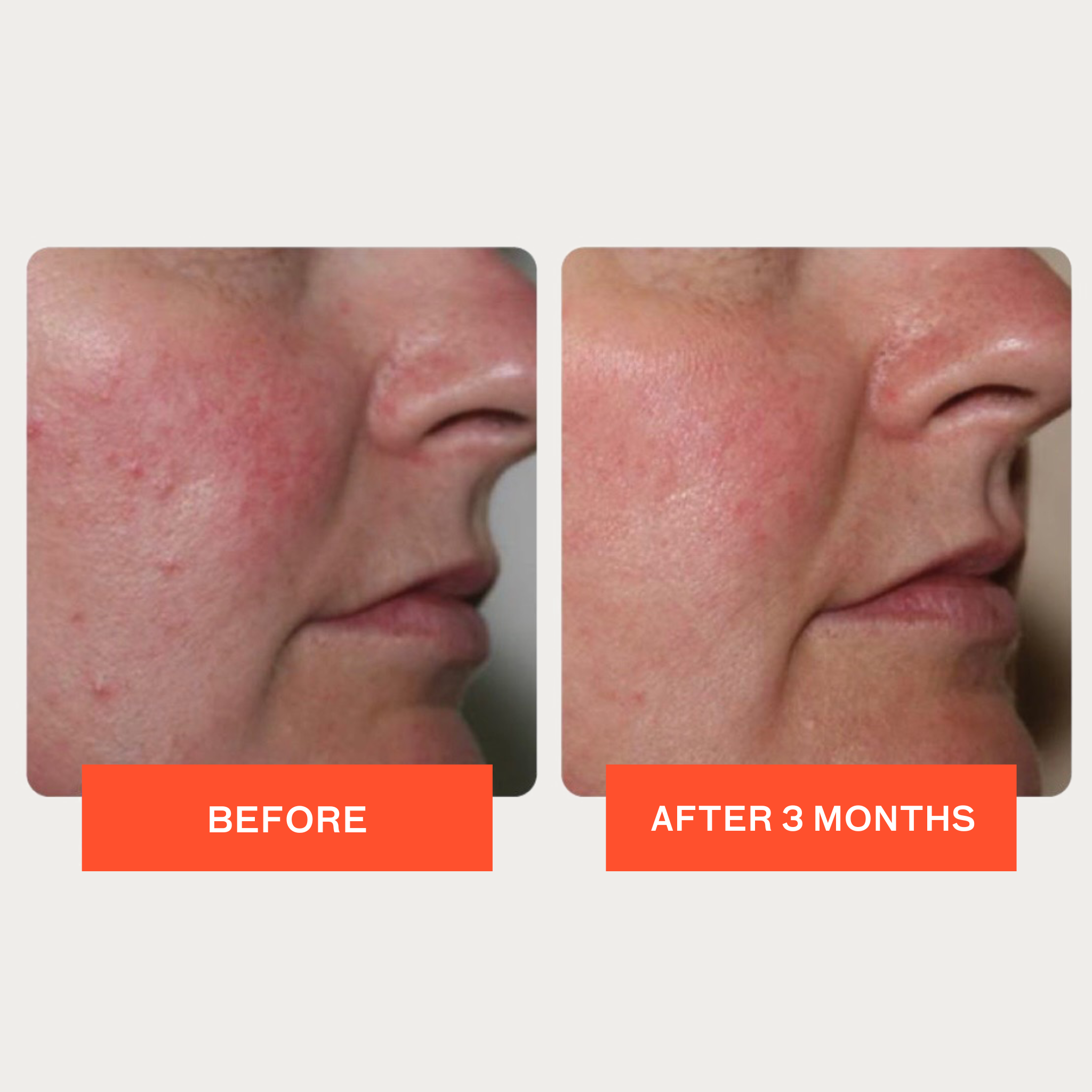 Pro-Heal Serum Advance+